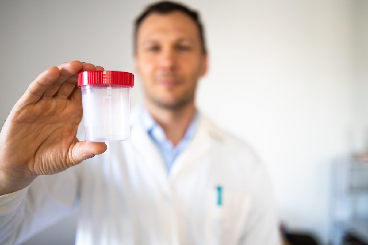 Doctor sosteniendo un vaso de orina para una prueba de drogas