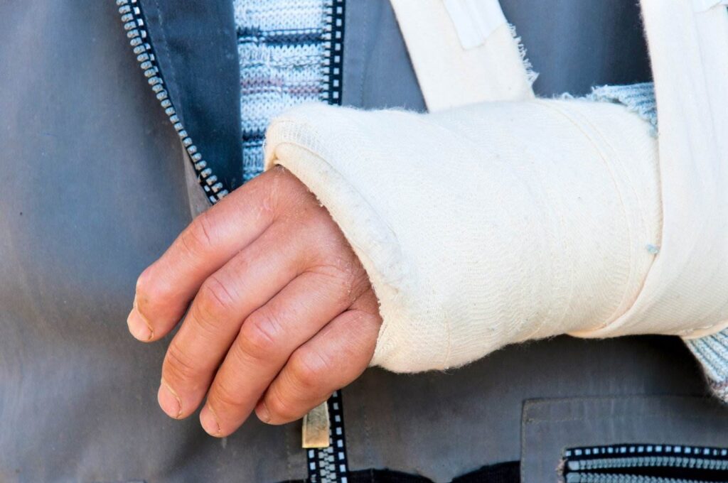 Close-up of hand in cast