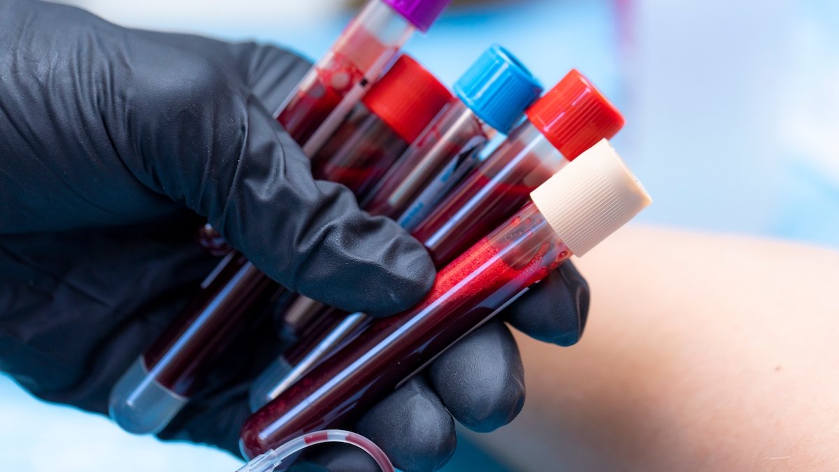 Gloved lab technician hand holding several vials of blood