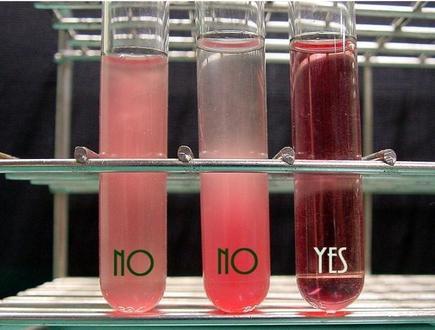 good and contaminated vials of blood (light pink, dark pink and red)